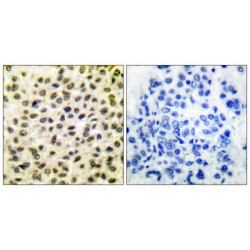 Proto-Oncogene C-Fos (FOS) Antibody