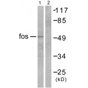 Western blot analysis of extracts from HepG2 cells, using Fos antibody (abx013037).