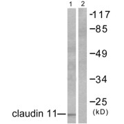 Western blot analysis of extracts from mouse brain, using Claudin 11 antibody (abx013040).