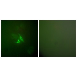 Prostaglandin G/H Synthase 2 / COX-2 (PTGS2) Antibody