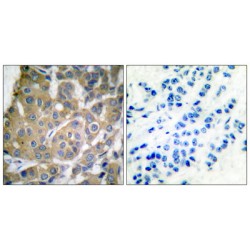 Prostaglandin G/H Synthase 2 / COX-2 (PTGS2) Antibody