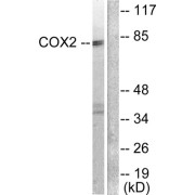 Western blot analysis of extracts from A549 cells, using PTGS2 antibody.