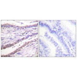 Cyclin A (CCNA) Antibody