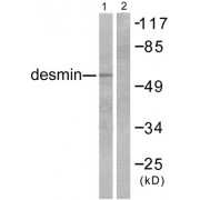 Western blot analysis of extracts from K562 cells, using Desmin antibody.