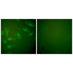 Protein DJ-1 (DJ-1) Antibody