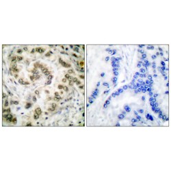 Transcription Factor E2F4 (E2F4) Antibody