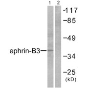 Western blot analysis of extracts from SKOV3 cells, using Ephrin B3 Antibody.