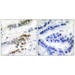 DNA Excision Repair Protein ERCC-1 (ERCC1) Antibody