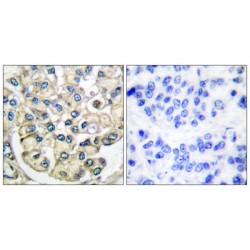 Fibroblast Growth Factor Receptor 2 (FGFR2) Antibody