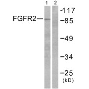 Western blot analysis of extracts from A549 cells, using FGFR2 antibody.