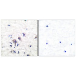 mGluR2 / 3 Antibody