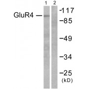 Western blot analysis of extracts from 293 cells, untreated or treated with Forskolin (40nM, 30mins), using GluR4 antibody (abx013092).