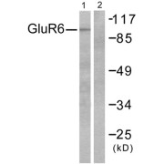 Western blot analysis of extracts from mouse brain, using GluR6 antibody (abx013094).