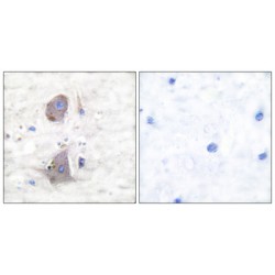 Solute Carrier Family 2, Facilitated Glucose Transporter Member 1 (SLC2A1) Antibody