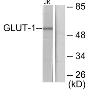 Western blot analysis of extracts from Jurkat cells, using GLUT1 antibody.