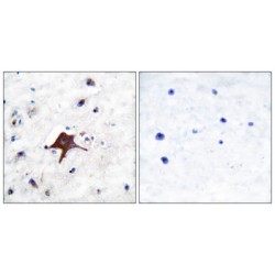 Solute Carrier Family 2, Facilitated Glucose Transporter Member 3 (SLC2A3) Antibody