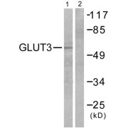 Western blot analysis of extracts from LOVO cells, using GLUT3 antibody (abx013098).