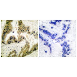 Histone Deacetylase 10 (HDAC10) Antibody