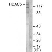 Western blot analysis of extracts from HepG2 cells, treated with PMA (125ng/ml, 30mins), using HDAC5 antibody (abx013106).