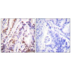 Histone Deacetylase 9 (HDAC9) Antibody