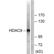 Western blot analysis of extracts from HepG2 cells, using HDAC9 antibody (abx013108).