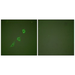 10 kDa Heat Shock Protein, Mitochondrial / HSP10 (HSPE1) Antibody