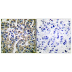 10 kDa Heat Shock Protein, Mitochondrial / HSP10 (HSPE1) Antibody