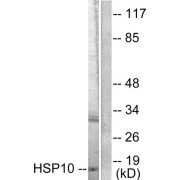 Western blot analysis of extracts from NIH/3T3 cells, using HSP10 antibody (abx013110).