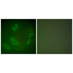 Heat Shock Protein 105 kDa (HSP105) Antibody