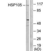 Western blot analysis of extracts from HeLa cells, using HSP105 antibody (abx013111).