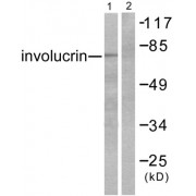 Western blot analysis of extracts from HuvEc cells, using Involucrin antibody (abx013116).