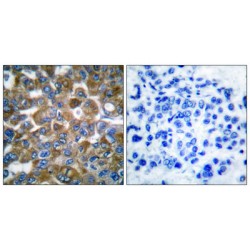 Keratin 15 (KRT15) Antibody