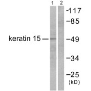 Western blot analysis of extracts from COS7 cells, using Keratin 15 antibody (abx013119).