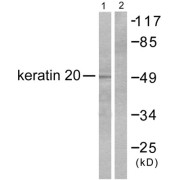 Western blot analysis of extracts from HeLa cells, using Keratin 20 antibody (abx013124).