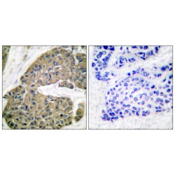 Keratin 5 (KRT5) Antibody