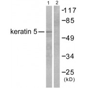 Western blot analysis of extracts from HepG2 cells, using Keratin 5 antibody (abx013125).