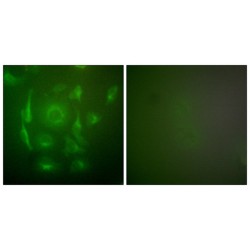 Keratin 7 (KRT7) Antibody