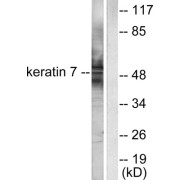 Western blot analysis of extracts from HepG2 cells, using Keratin 7 antibody (abx013126).