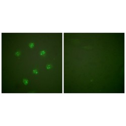 Proliferation Marker Protein Ki-67 (MKI67) Antibody