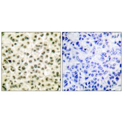 Ku80 Antibody