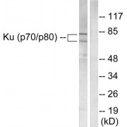 Western blot analysis of extracts from LOVO cells, using Ku70/80 antibody (abx013131). The lane on the right is treated with synthetic peptide.