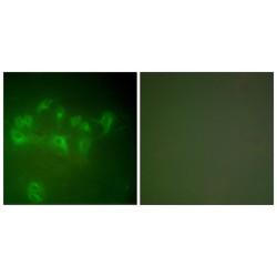 Mdm2 p53 Binding Protein Homolog (MDM2) Antibody