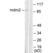 Western blot analysis of extracts from SKOV3 cells, using MDM2 antibody (abx013139). The lane on the right is treated with a synthetic peptide.