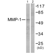 Western blot analysis of extracts from HepG2 cells, using MMP-1 antibody (abx013140).