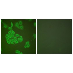 Matrix Metalloproteinase 11 (MMP11) Antibody