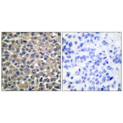 Matrix Metalloproteinase-19 (MMP-19) Antibody