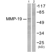 Western blot analysis of extracts from HuvEc cells, using MMP-19 antibody (abx013146).