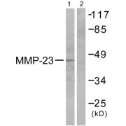 Western blot analysis of extracts from SK-OV3 cells, using MMP-23 antibody (abx013148).