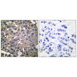 Matrix Metalloproteinase-9 (MMP9) Antibody