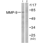 Western blot analysis of extracts from HepG2 cells, using MMP9 antibody (abx013152).